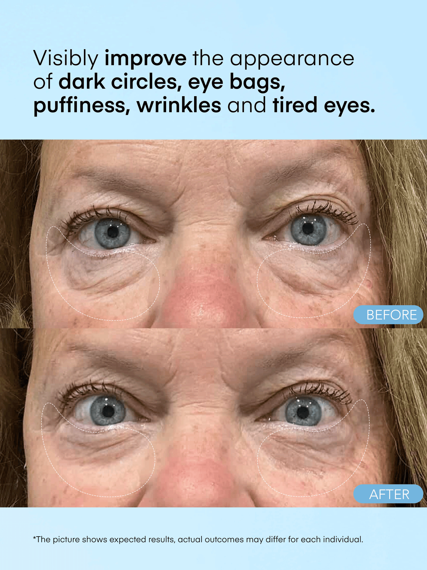 Caffeine & Hyaluronic Acid Eye Gel Patch upsell