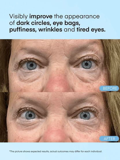 Caffeine & Hyaluronic Acid Eye Gel Patch upsell