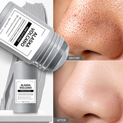 Pore & Acne Clay Mask Stick upsell